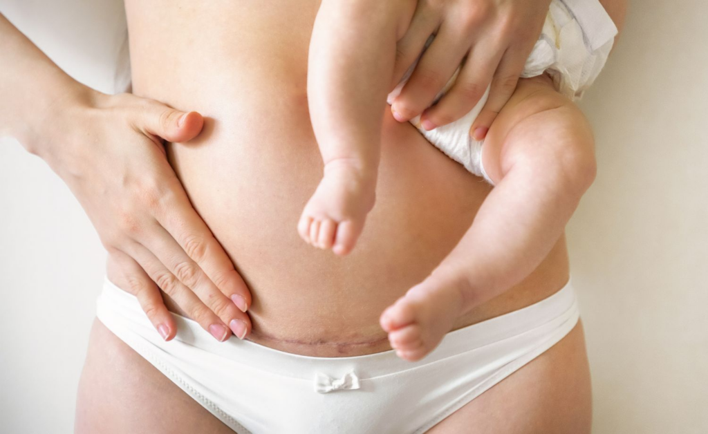 Exercícios de Kegel 