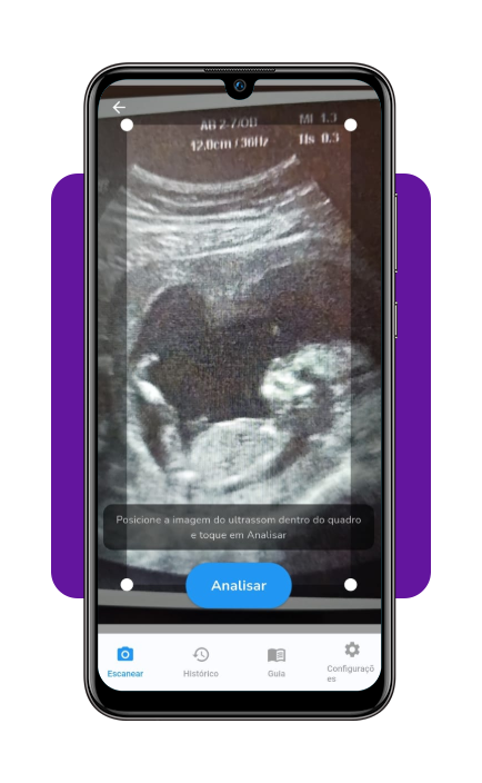 Teste digital grátis que analisa ultrassom para prever o sexo do bebê 4 IMG 4460 03