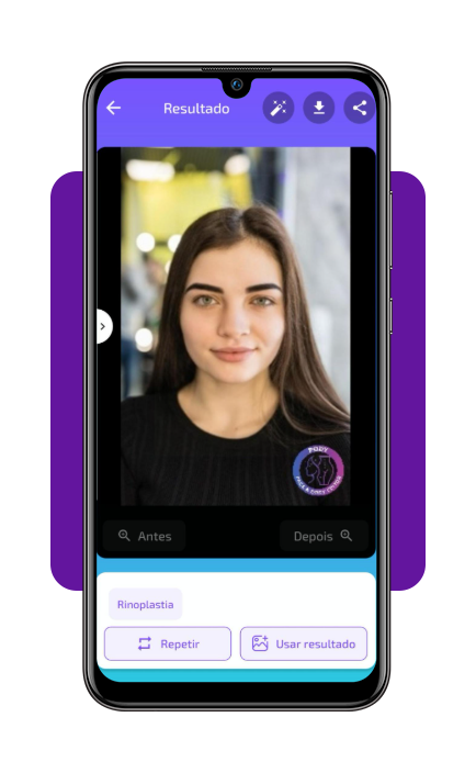 Aplicativo para simular sua rinoplastia grátis por foto no celular 7 IMG 4854 06